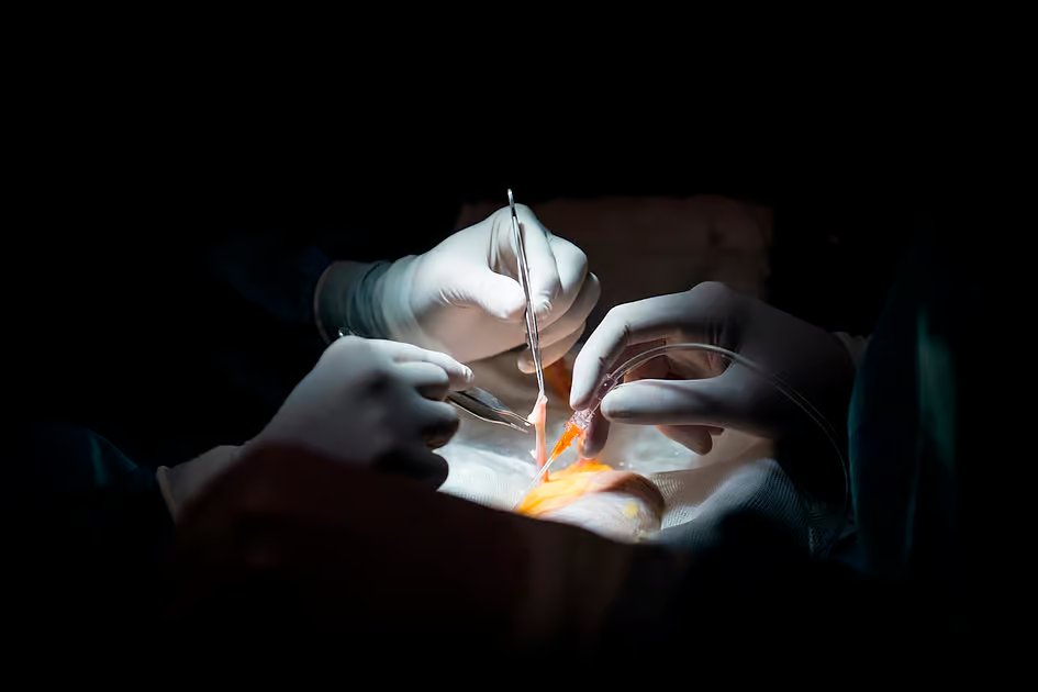 UAE records more than 1,195 organ transplants as 39,000 register as donors