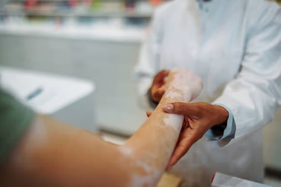 UAE becomes first in the world to approve pill to treat non-segmental vitiligo